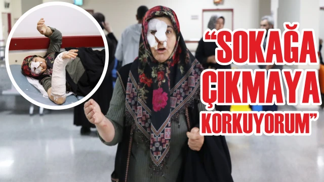 SOKAK KÖPEKLERİ DEHŞET SAÇTI